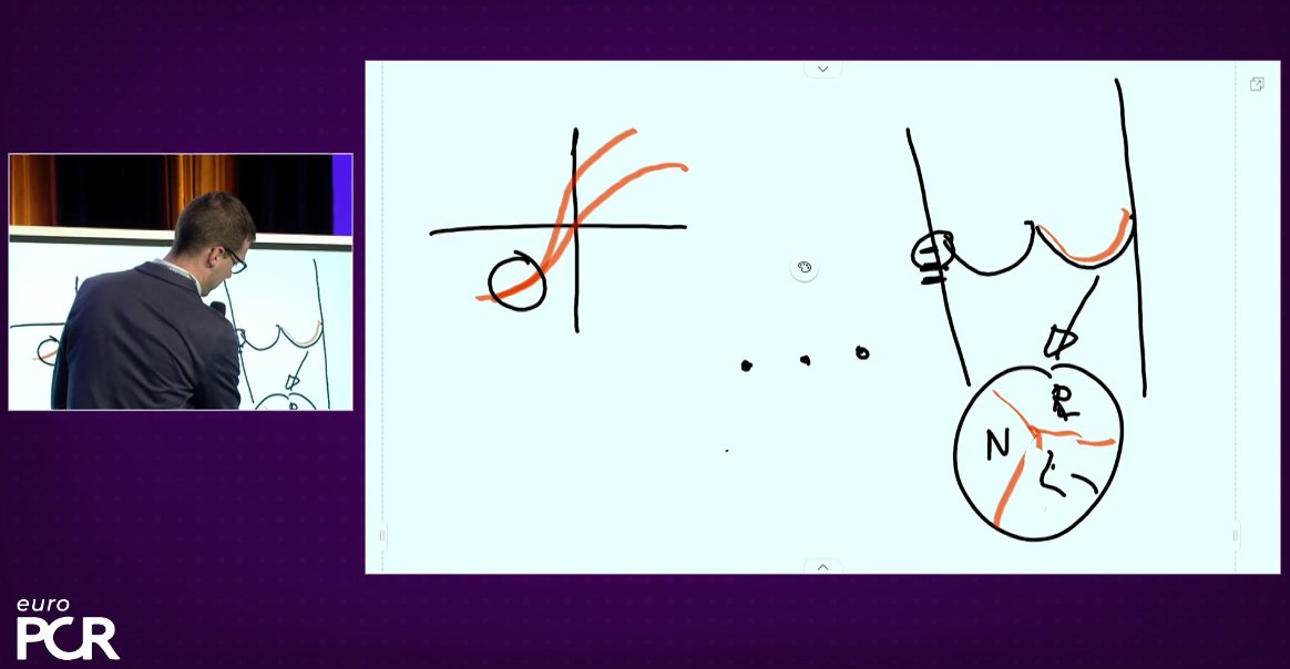 Simple anatomy: which valve for which patient? Watch the replay of this practical session📺 pcronline.com/Cases-resource… Learn more about 🟣the influence of valve design on hemodynamic performance and durability 🟣risk factors associated with TAVI in bicuspid aortic valves 🟣the…