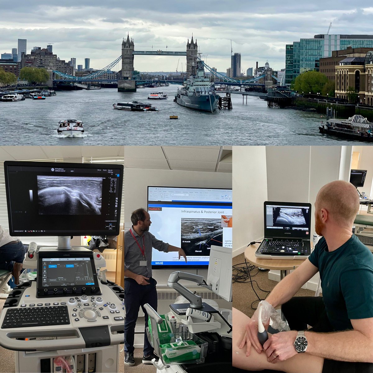 A smashing time in London with more MSK Ultrasound training @SMUGcourses Top class machines & even a wee hamstring masterclass from HSI wizard🧙‍♀️@PhysioButler 😉 Lots of cross-sport chat with physio/docs 🦴🦵💪🏼 ⚽️ 🏉 🏃‍♀️ 🏋️‍♀️ #sportsmed #orthotwitter