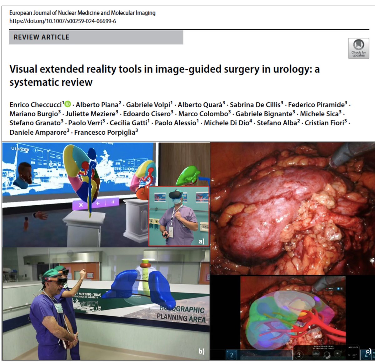 👓Currently, 40 studies are assessing the role of extended reality in urology! 🌰11 for prostate cancer 🫘 20 for kidney cancer 🟡🪨9 for bladder cancer and lithiasis New tools for image guided surgery! @PorpigliaF #AugmentedReality #VirtualReality 👉link.springer.com/article/10.100…