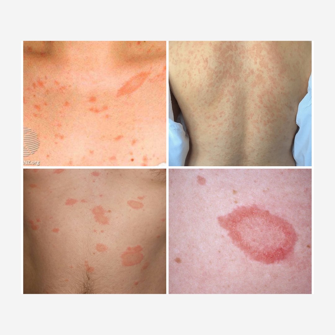 Dermatology Interest Group tweet media