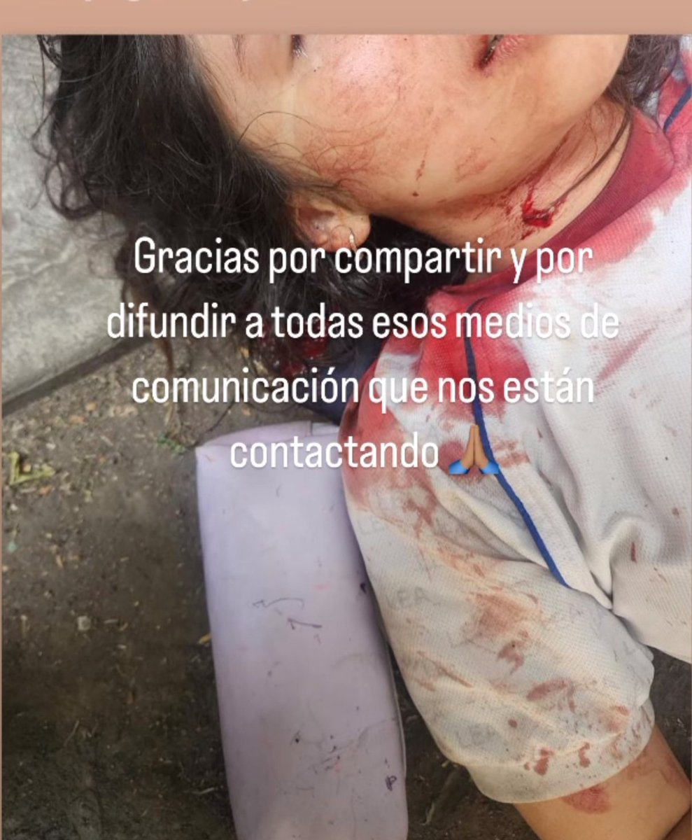 Libro_negro_'s tweet image. #INDIGNANTE 🔴| Denuncian en redes sociales que una niña de 13 años fue acuchillada por su ex-novio de también 13 años en las afueras de la escuela Liceo de Emperadores Azteca, la niña fue acuchillada en 15 ocasiones pero aun así el ex novio esta libre por su edad.

¡Exigimos