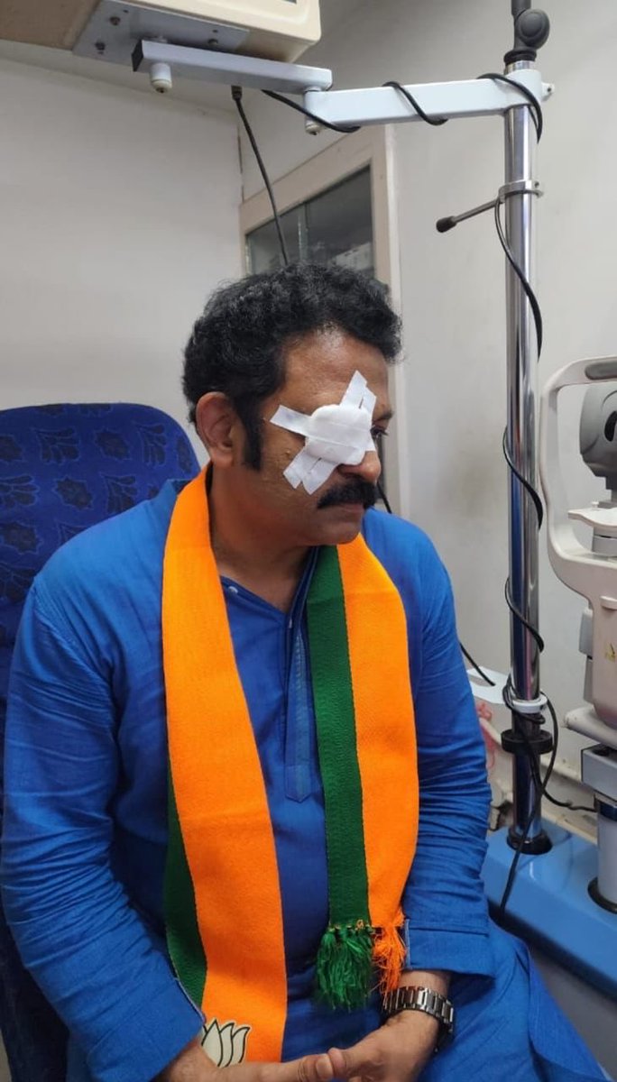 Kollam BJP candidate Krishnakumar attacked by sharp projectile while campaigning today. The hitherto dormant violence in Kerala’s elections is finally here 😏