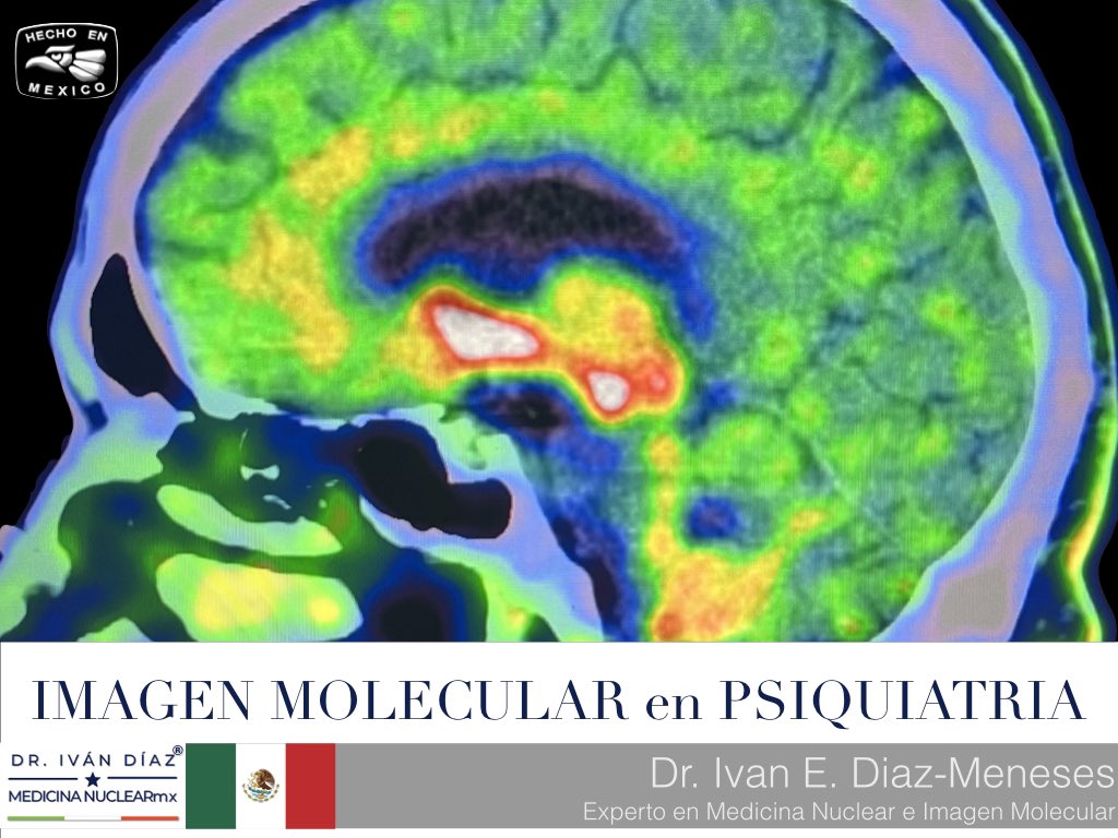 The #BRAIN 🧠 what a such marvel! In the Mexican congress of #nuclearmedicine & #molecularimaging I will talk about #mental illness and what we know through this wonderful medical technology! |