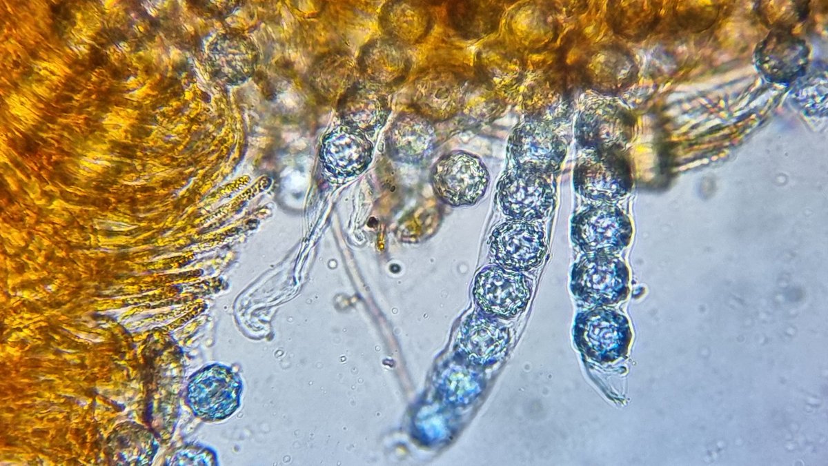 Jamiewa50042387's tweet photo. Lamprospora pseudoarvensis,on Pleuridium,on the bear earth of a rabbit burrow today on British camp on the Malvern Hills ,third ever uk record for this Bryoparasitic Pezizal sp . https://t.co/sB3F8F5b7w