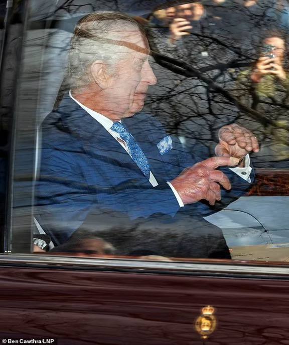 What's happening with Charles’s hands? LINK 👇 t.me/+8VgcD2md-EdkM…