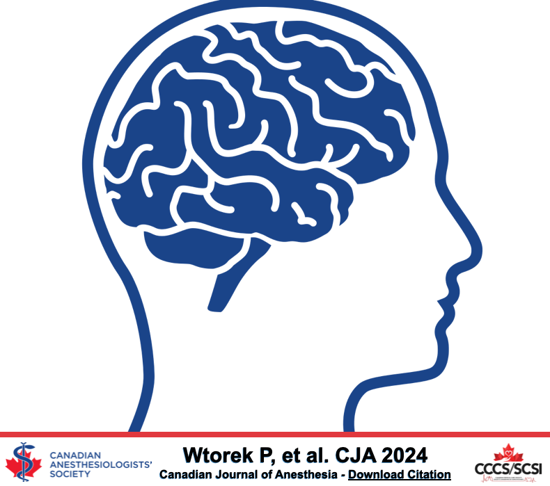 Beliefs of physician directors on the management of devastating brain injuries at the Canadian emergency department and intensive care unit interface: a national site-level survey - Canadian Journal of Anesthesia #CJA #CJA2024 #Anesthesia rdcu.be/dDXph