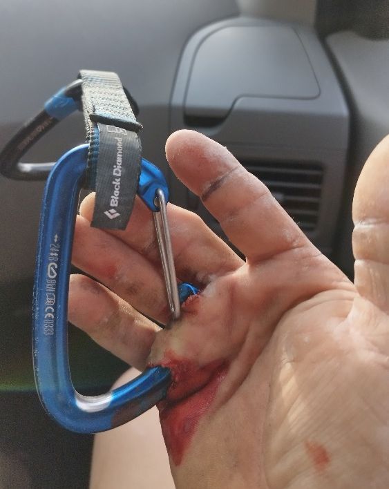 4sportua's tweet image. Shocking photo: injury of a #climber who fell from the rock route (on Adršpach-Teplice Rocks) while holding a #quickdraw carabiner; according by lezec.cz

4sport.ua