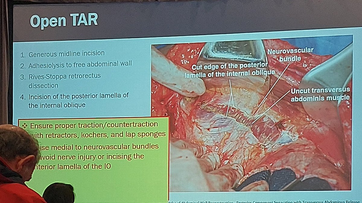 SebastianShu's tweet photo. Learned a lot about complex hernia repair, managent of bariatric complications, OABG, SADI-S, the future with GLP1 RA, surgical sustainability...the list is long. https://t.co/BQswe2rVFZ