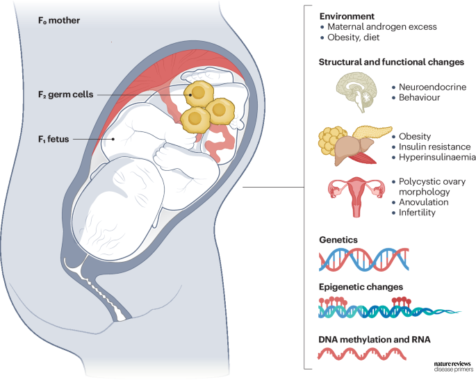 The inheritance of #PCOS likely involves genetic, environmental and epigenetic factors go.nature.com/3w0S7U7