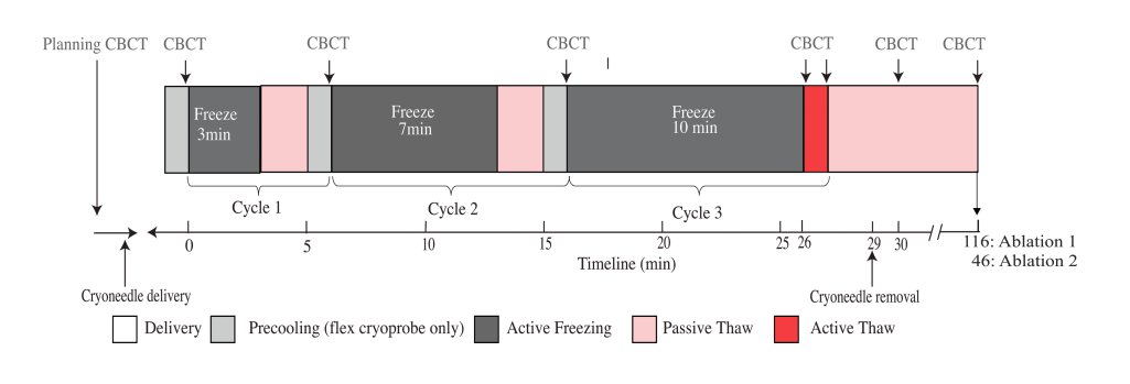 📢 Exciting news from @JVIRmedia: A prototype flexible transbronchial cryoprobe shows promise in an in vivo swine model! 🐷🔬 Comparing it to percutaneous transthoracic cryoablation and defining imaging features. @SIRspecialists @SIO_Central Let's dive in! 🩺📊 Study…