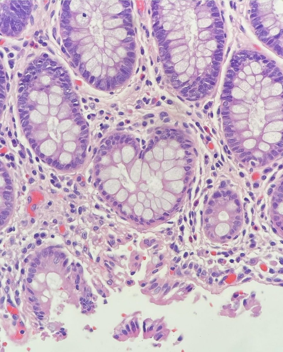 ubpathology tweet picture