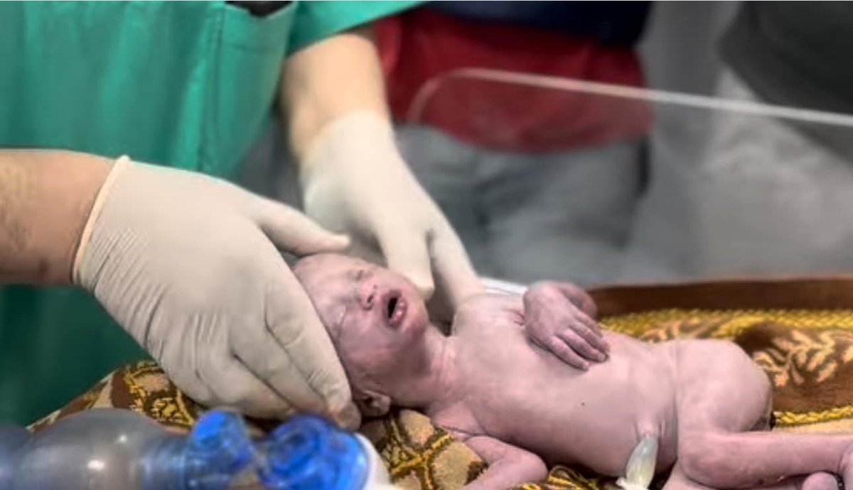 Israeli occupation forces just bombed a house in Rafah. A pregnant woman was killed, but doctors managed to save the baby's life. Can you understand the absolutely horrific way in which this child was born into this world ?