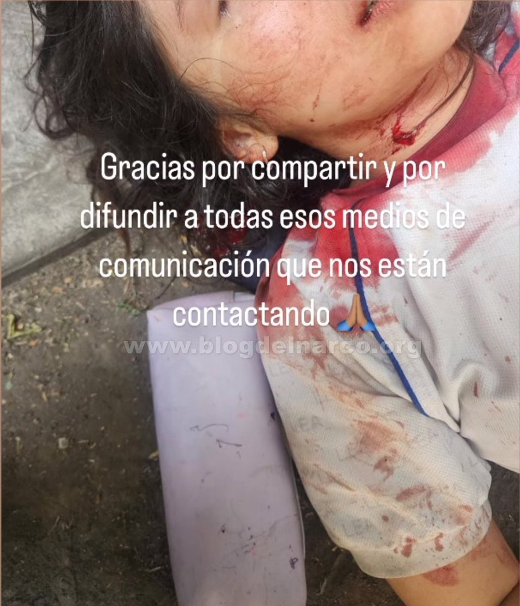 Niña de 13 años fue acuchillada 15 veces por su ex-novio también de 13 años afuera de la secundaria Liceo Emperadores Azteca en Iztapalapa, a pesar de que intento asesinar a la jovencita el Ministerio Publico abrió la carpeta de investigación solo por lesiones y no por tentativa