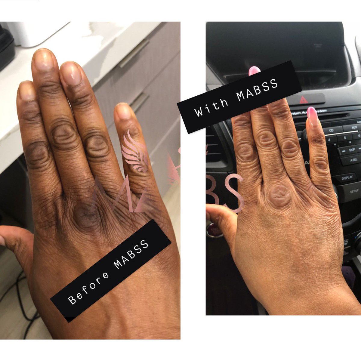 MABSS18's tweet photo. What’s your skin concerns? Mabss skincare is here to give you the best in skincare #OrganicBEAUTY #organicskincare https://t.co/ISM1XAzwAG