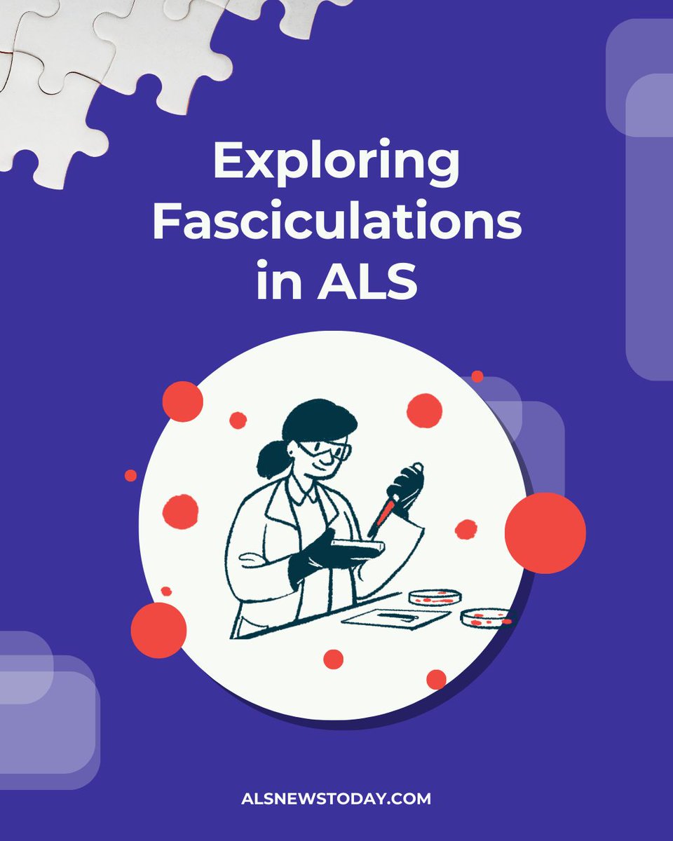 Did you know that ALS muscle twitches are often associated with a person’s dominant hand? Learn more about muscle twitching here: bit.ly/3U4vUg1 

#ALS #AmyotrophicLateralSclerosis #ALSCommunity #LivingWithALS #ALSAwareness