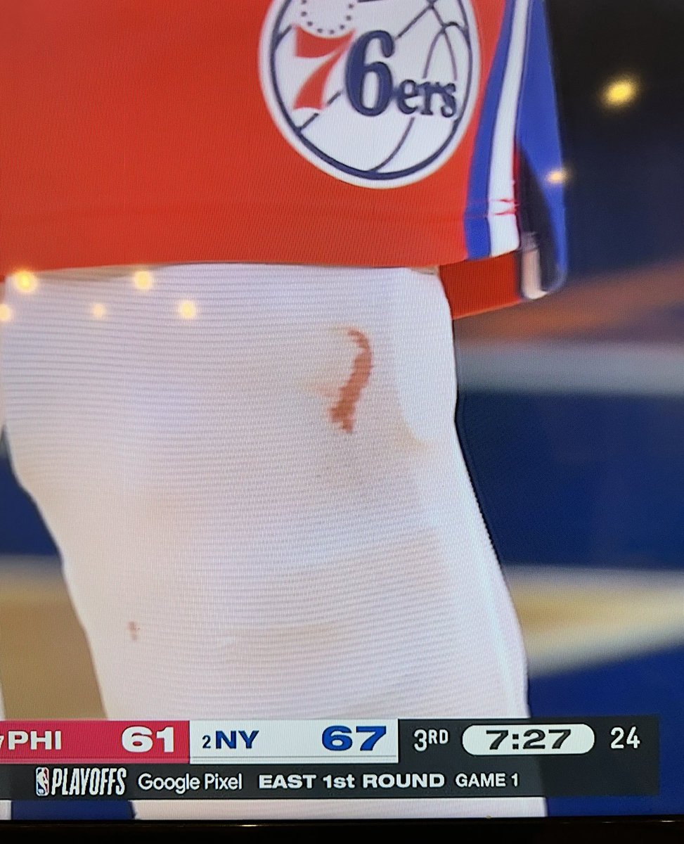 Joel Embiid (@JoelEmbiid) with the basketball version of the @gehrig38 bloody sock? Cortisone injection? Toradol? #knicks #NBAPlayoffs