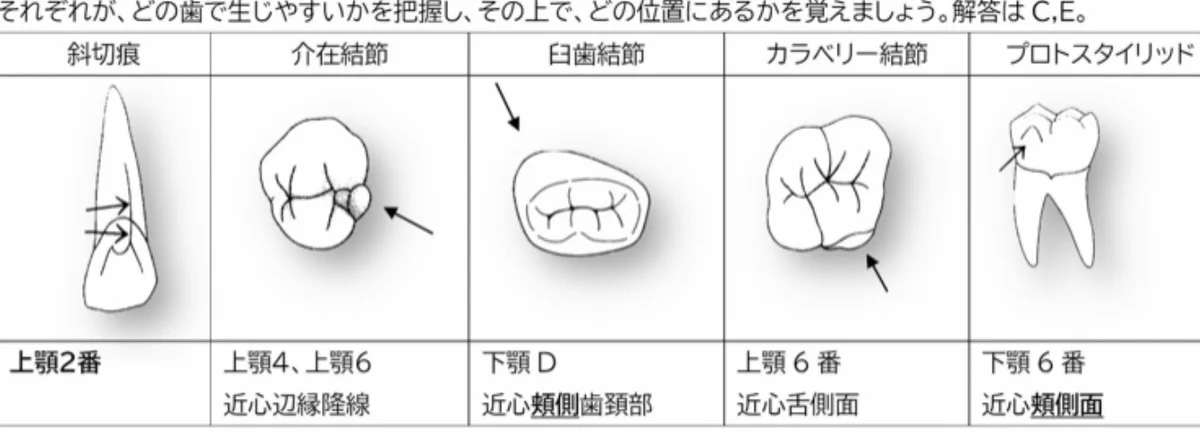歯科医師国家試験対策 ロムニーハウス勉強会【講師 Dr.N】 on X: 