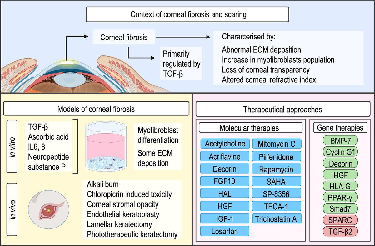 ADDR in press: Corneal fibrosis: From in vitro models to current and upcoming drug and gene medicines. By Dimitrios I. Zeugolis & coworkers @ucddublin @UKICRS @CRS_FG_Ocular #GeneTherapy #CornealFibrosis doi.org/10.1016/j.addr…