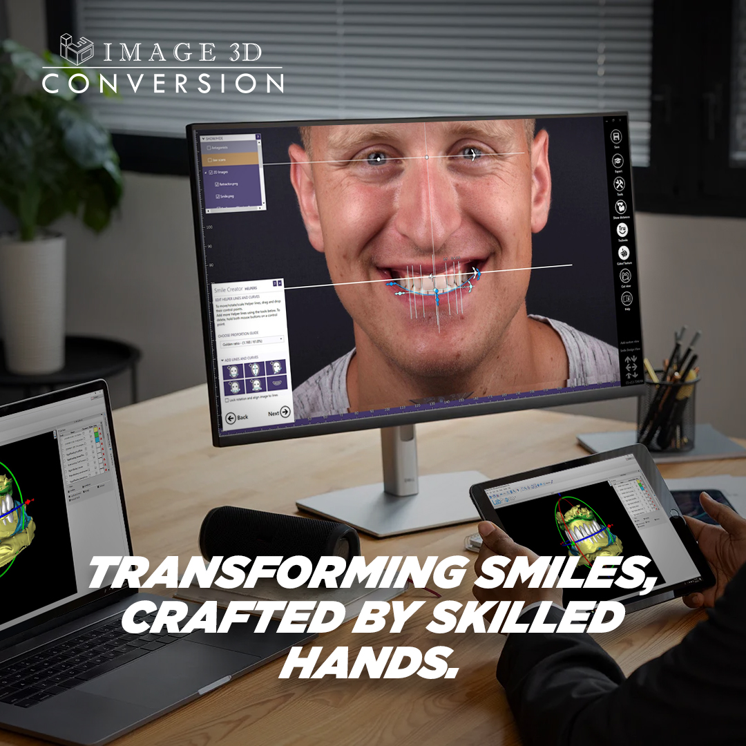 Behind every radiant smile lies the error- free and expertise of our dedicated team. Explore the art and science of Full-Mouth Reconstruction as we redefine excellence in care, one restoration at a time. 

#image3dconversion #bonereductionguide #blueskyplan #guidedimplantsurgery