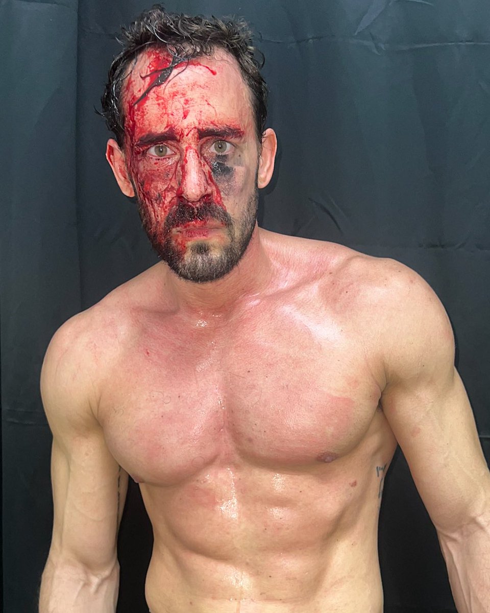 Every war leaves a scar. 

(Ariel Levy following last night’s Tag Team Title match against The QROWN)

#ccw #prowrestling #portstlucie