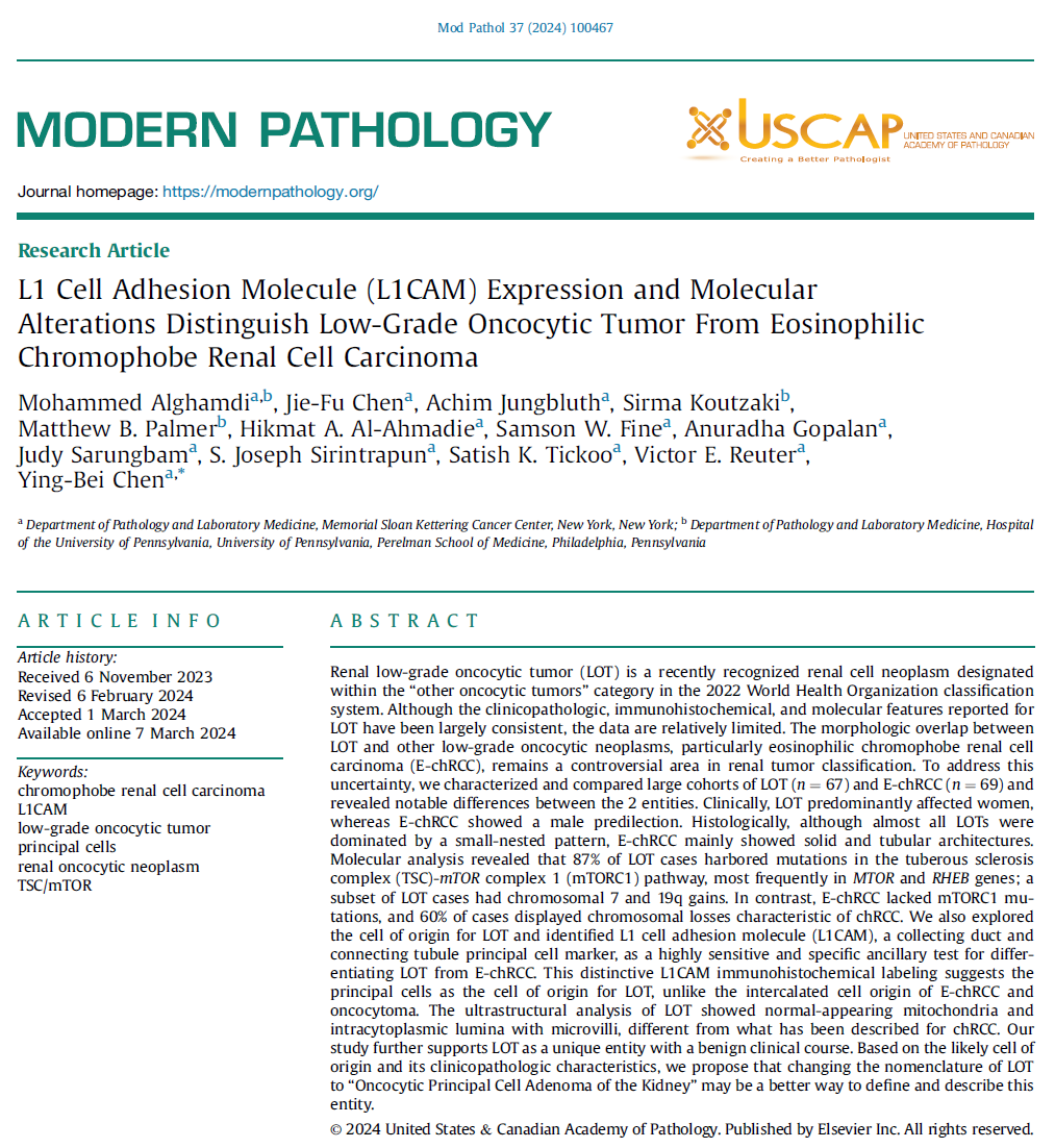 JUST when I got my urologists to understand what I meant when I diagnose🔬'LOT' (low grade oncocytic tumor) in my #GUpath nephrectomy reports... 👀PMID: 38460672 proposal to change nomenclature of LOT to 'Oncocytic Principal Cell Adenoma of the Kidney' 👇🏽