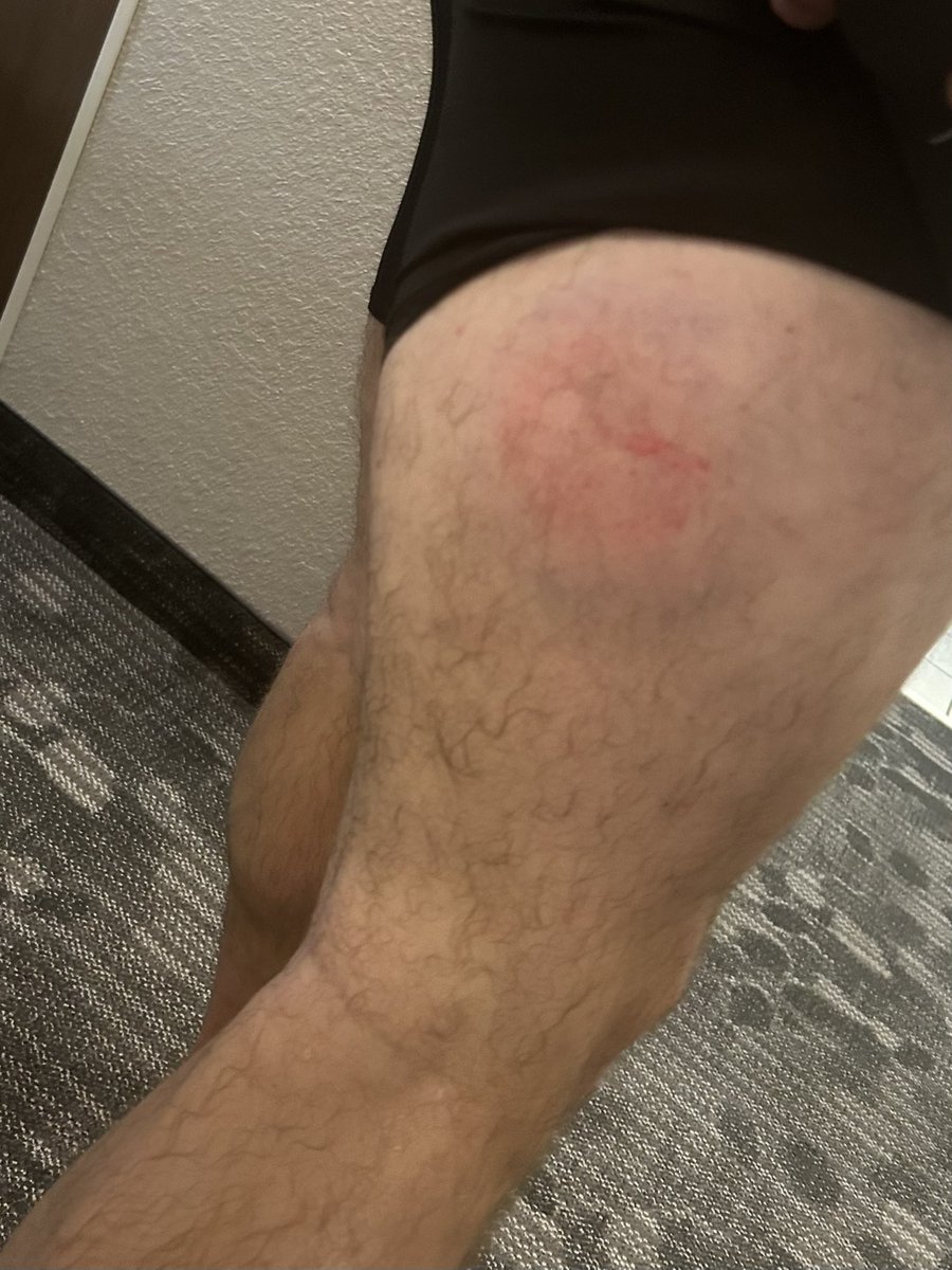 Nolans thought process- Ouch, this is gonna hurt… hey, what happened nothing to see here, oh gosh I’m on tv don’t rub it 😂 Nice one <a href="/B_mont_/">Braden Montgomery</a> 104 off the hammy 🤣. Sry, had to <a href="/ncain39/">Nolan Cain</a> 🩷🩷