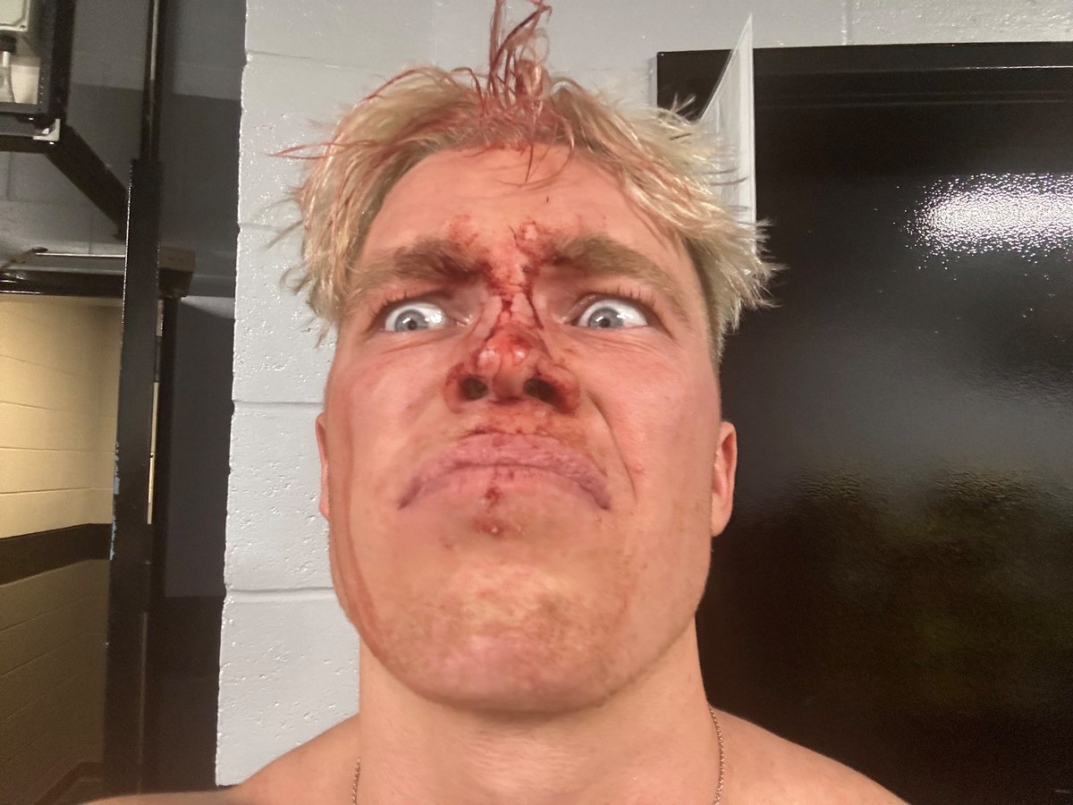 kylefletcherpro's tweet photo. WHY DID NOONE TELL ME WHAT A BUNKHOUSE BRAWL WAS https://t.co/30BsDYNNlX