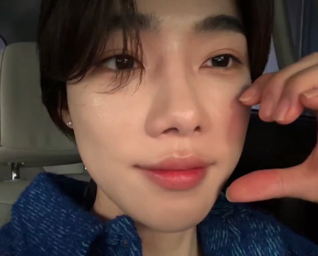 차니시 🫶🏻🥔