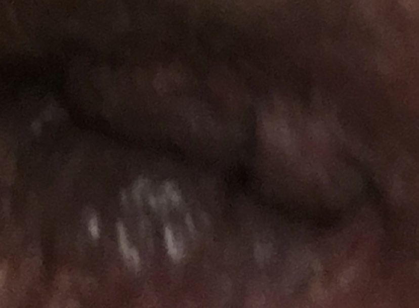 @AlboMP @sydneyswans @Redkite So this is a super zoomed in close-up of my arsehole!

@AlboMP I’m showing you this as a demonstration of how much the Australian people respect you!

#auspol