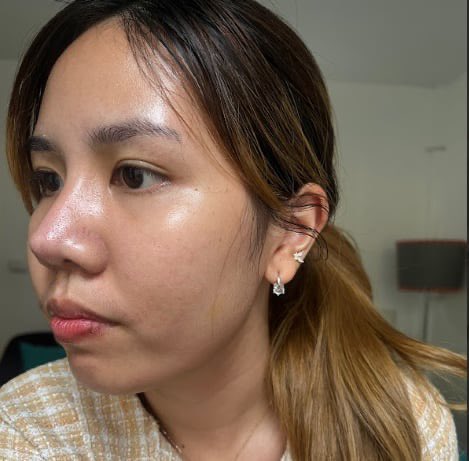 PJSahutsaya's tweet image. อยากจะบอกต่อแบบบอกต่อจริงๆ ตัวนี้กินเองแบบ100% บอกเลยว่ากินต่อเนื่องแล้วผิวดีมาก จากที่สิวอุดตันเยอะๆตอนนี้มีน้อยมากๆ หน้าเนียนขึ้น สิวอักเสบลดลง จากเดิมเป็นประจำเดือนทีก็บุกมาแบบตรึมอะ แต่พอกินตัวนี้เป็นประจำคือหน้าดีขึ้นจริงอันนี้ส่วนต้วนะ ให้เป็นเดอะเบสอะ #nectapharma…