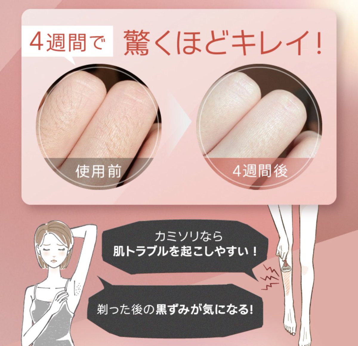 💦初心者🔰オススメします❤️‍🩹

【クーポン利用で16,500円！4/20～4/21】脱毛器 Ulike 公式 IPL 光脱毛器 Air 家庭用脱毛器 メンズ レディース男女兼用 vio対応 脱毛 無痛 送料無料 サファイア冷感脱毛器 レーザー IPL 光美容器 ムダ毛ケア  顔と全身用モデル  白🏝️🏝️
room.rakuten.co.jp/room_add83970d…