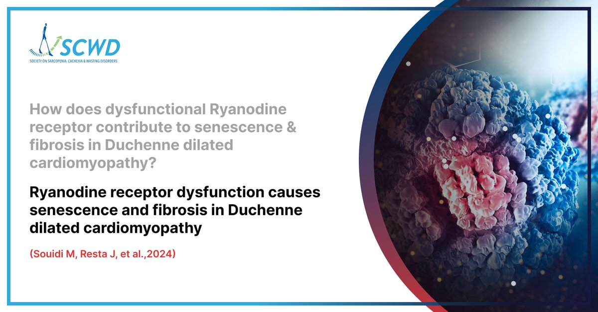 Looking into the complex changes of Duchenne dilated cardiomyopathy: Could dysfunctional Ryanodine receptors hold the key to understanding senescence & fibrosis? 

#Research #Cardiomyopathy #MuscularDystrophy #SCWD #Sarcopenia #Cachexia #WastingDisorders