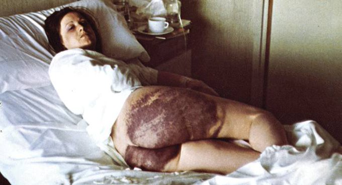 Un 21 de abril como hoy, pero de 1976, el cuerpo magullado de Amparo Arangoa podía verse en todos los rincones del mundo. 

Las imágenes publicadas en Zeruko Argian se difundieron inmediatamente en Euskal Herria, porque demostraban que hubo tortura. 

Los familiares y los autores