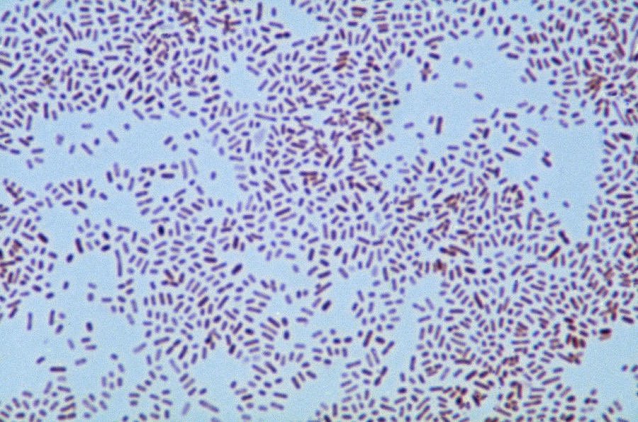siralkhtim11's tweet photo. ماهو اسم البكتريا و ما المرض الذي تسببه؟
Name of the causative agent and what is the name of the disease ? 🤔
#MicroRound
#Microlab #bacteriology #Micro #IDTwitter https://t.co/2lbBLqXikh