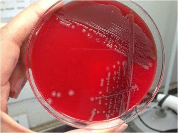 siralkhtim11's tweet photo. ماهو اسم البكتريا و ما المرض الذي تسببه؟
Name of the causative agent and what is the name of the disease ? 🤔
#MicroRound
#Microlab #bacteriology #Micro #IDTwitter https://t.co/2lbBLqXikh
