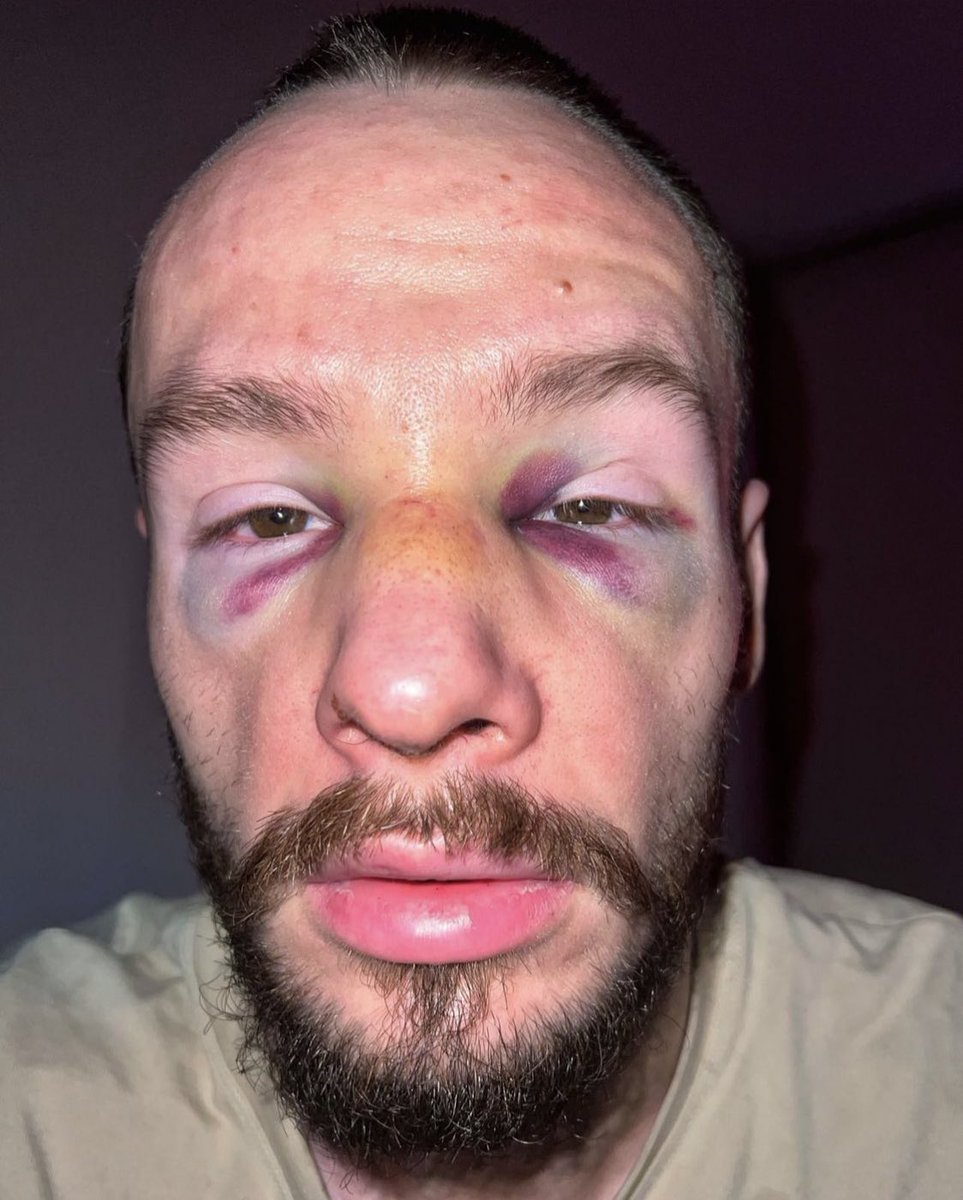 mikkelele_'s tweet photo. tak sie konczy kurwa obciaganie w lesie za krysztal (i to nawet nie jest zart) xdddd https://t.co/YvQ3R1zBBo