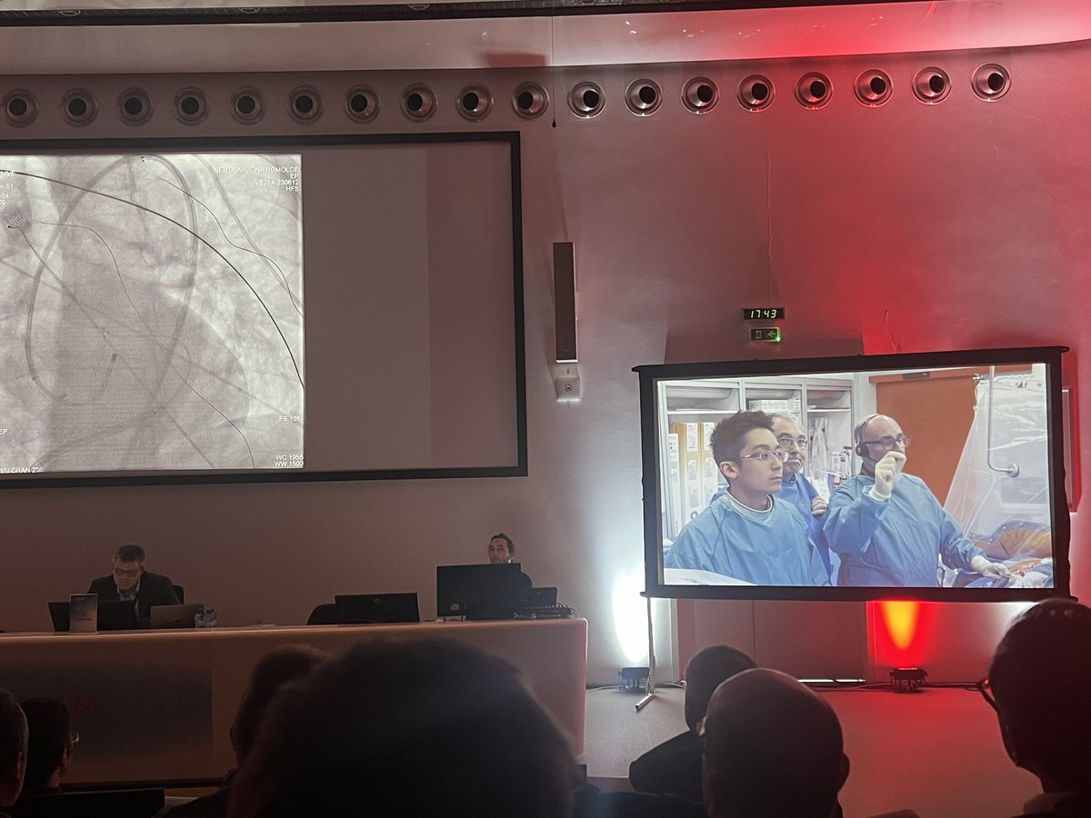 Four simultaneous live cases @PragueRhythm 2024 by @DrFerminGarcia @JosefKautzner @Dr_Santangeli @aportasanchez @VivekReddyMD