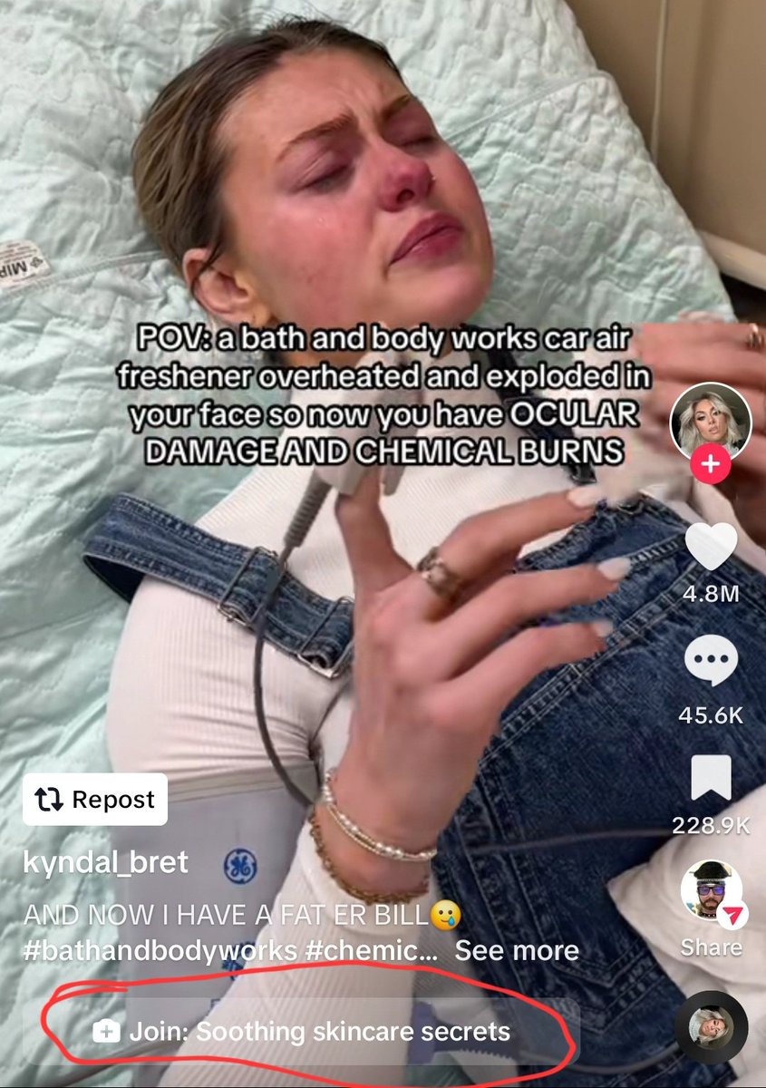 When your ML algorithm takes the assignment too literally, ignoring context: Pictured: woman suffering chemical burns. Algo: 'Join: soothing skincare secrets'