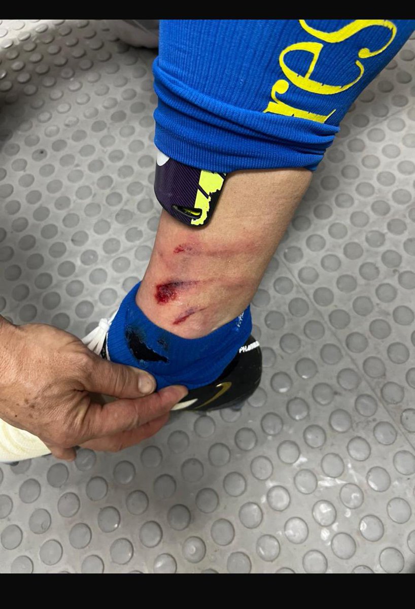 Al <a href="/ClubAmerica/">Club América</a> le ayudan los árbitros.