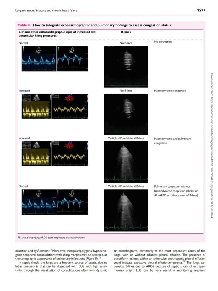 🔴 Lung ultrasound in acute and chronic heart failure: a #2023clinical consensus statement of the EACVI

academic.oup.com/ehjcimaging/ar…
 #CardioEd #Cardiology #meded #CardioTwitter
