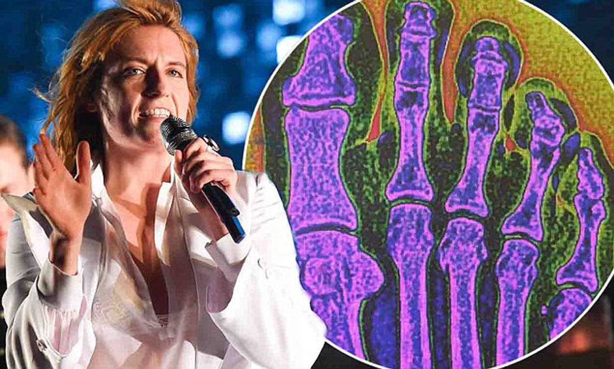tiger_brooke's tweet photo. Florence Welch and her broken foot. https://t.co/nk6pqbjJeG