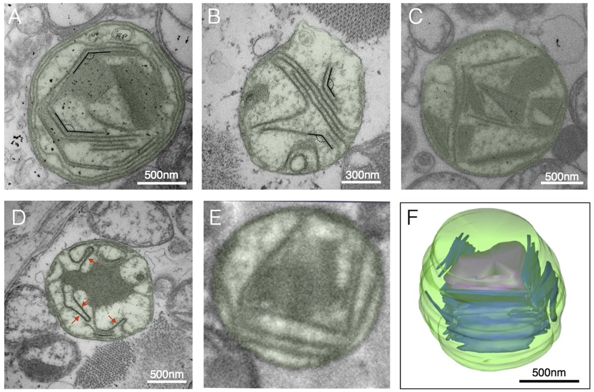 Martin Picard (@mitopsychobio) on Twitter photo Some of the amazing and strangest mitochondria we have seen, from the leg muscle of a person with a rare mtDNA mutation (m.8344A>G)
Notice the regular angles!
Work by <a href="/AmyV91/">Dr. Amy Vincent (She/Her) AmyVincent@mstdn.science</a>
Source: nature.com/articles/srep3… Some of the amazing and strangest mitochondria we have seen, from the leg muscle of a person with a rare mtDNA mutation (m.8344A>G)
Notice the regular angles!
Work by <a href="/AmyV91/">Dr. Amy Vincent (She/Her) AmyVincent@mstdn.science</a>
Source: nature.com/articles/srep3…