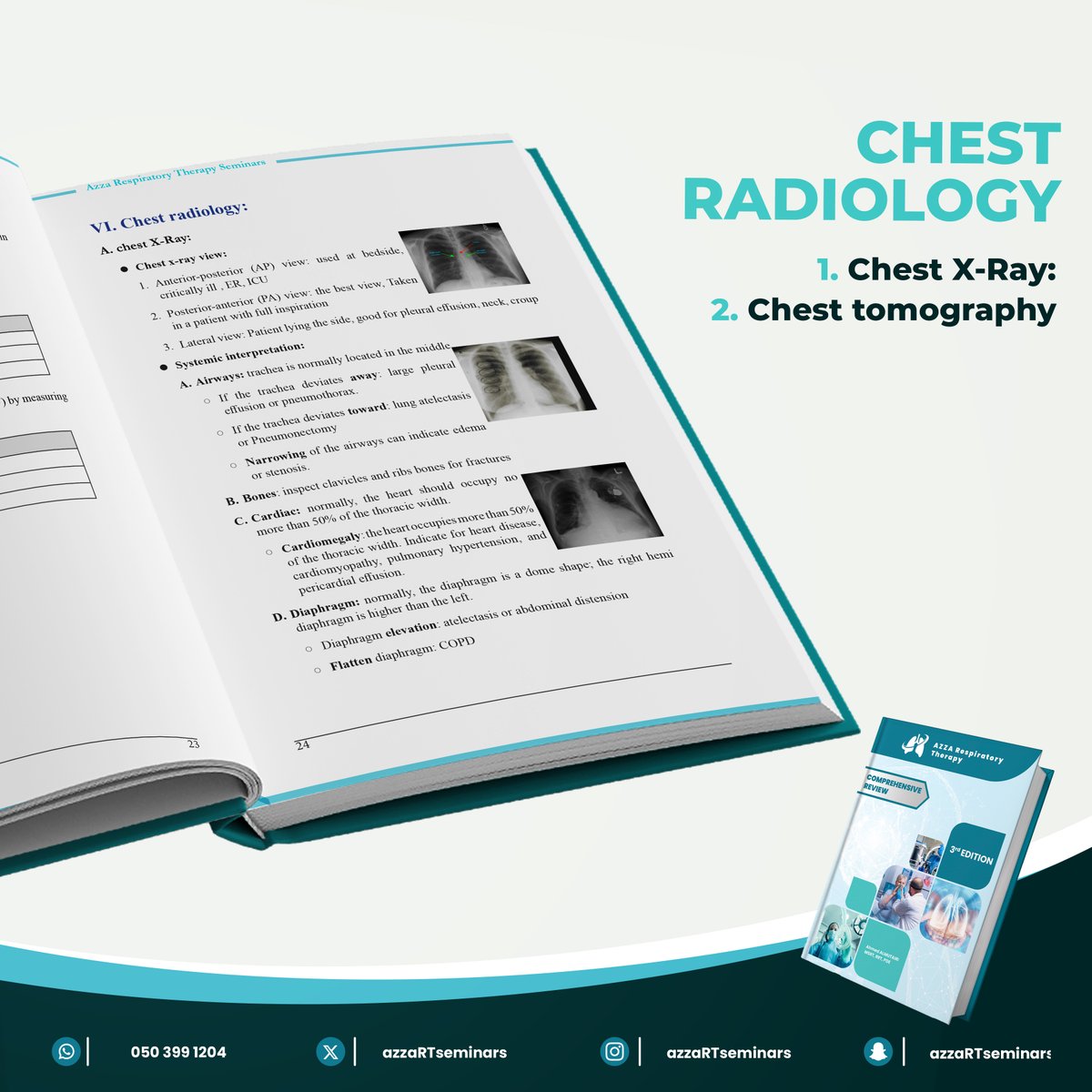 Master the art of chest imaging! Dive into X-ray and CT techniques with our Comprehensive Review Book! Enhance your skills in respiratory therapy with all the essential info in one place.
Get your discounted copy now: salla.sa/azzartseminars…

#RespiratoryTherapy #ChestRadiology📖