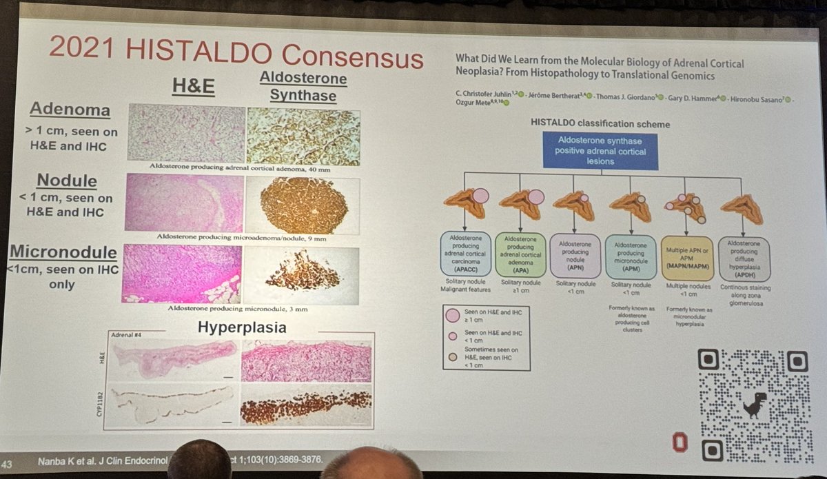 Great work by ⁦@OSUEndoSurgBSM⁩ ⁦@Tom_J_Giordano⁩ and team in developing a histologic system for Aldo synthase ⁦@TheAAES⁩ #aaes2024