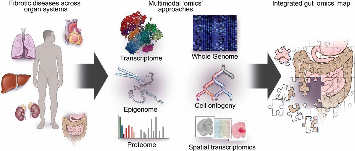 #GUTImages from the #RecentAdvancesInClinicalPractice paper by @IBD_FloMD et al entitled 'Fibrosis in IBD: from pathogenesis to therapeutic targets' via bit.ly/4aLgTpO @CleClinicMD @pranab_IBD #Fibrosis #IBD