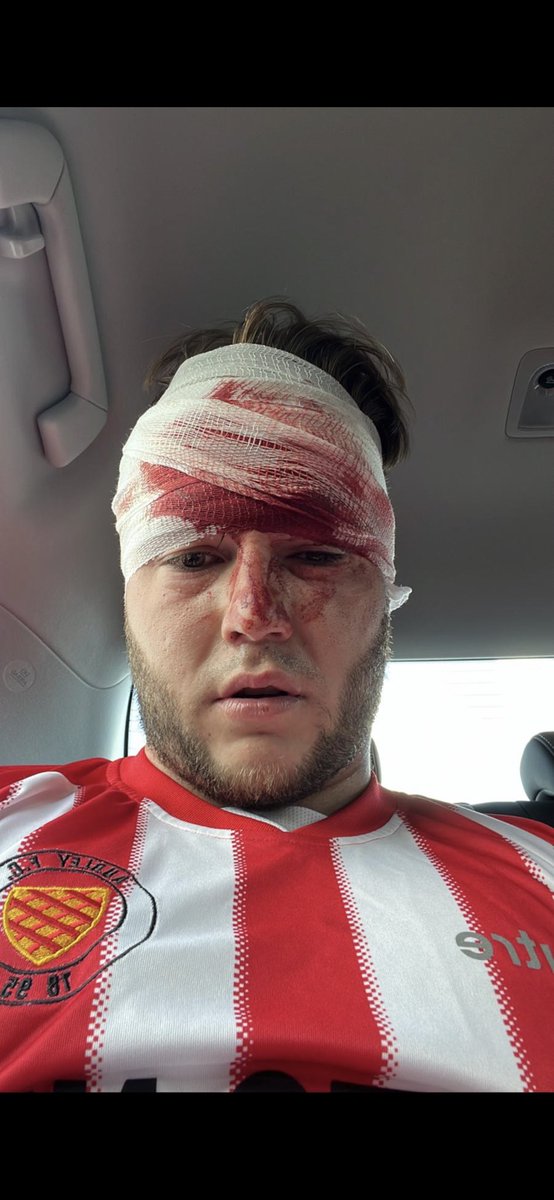 Furlong 4-0 Redgate Sundays

Into another cup final we go! Dominant from the get go! UTF🏆❤️

⚽️ <a href="/widgetomlin10/">Liam Tomlin</a> 
⚽️ <a href="/ryjames96/">Ry</a> 
⚽️ <a href="/joshuabennett_/">Joshua™</a> 
⚽️ <a href="/callum_ward1/">cal</a> 

MOTM-
Diesel throwing back the years, class performance from Darrel the Barrel!