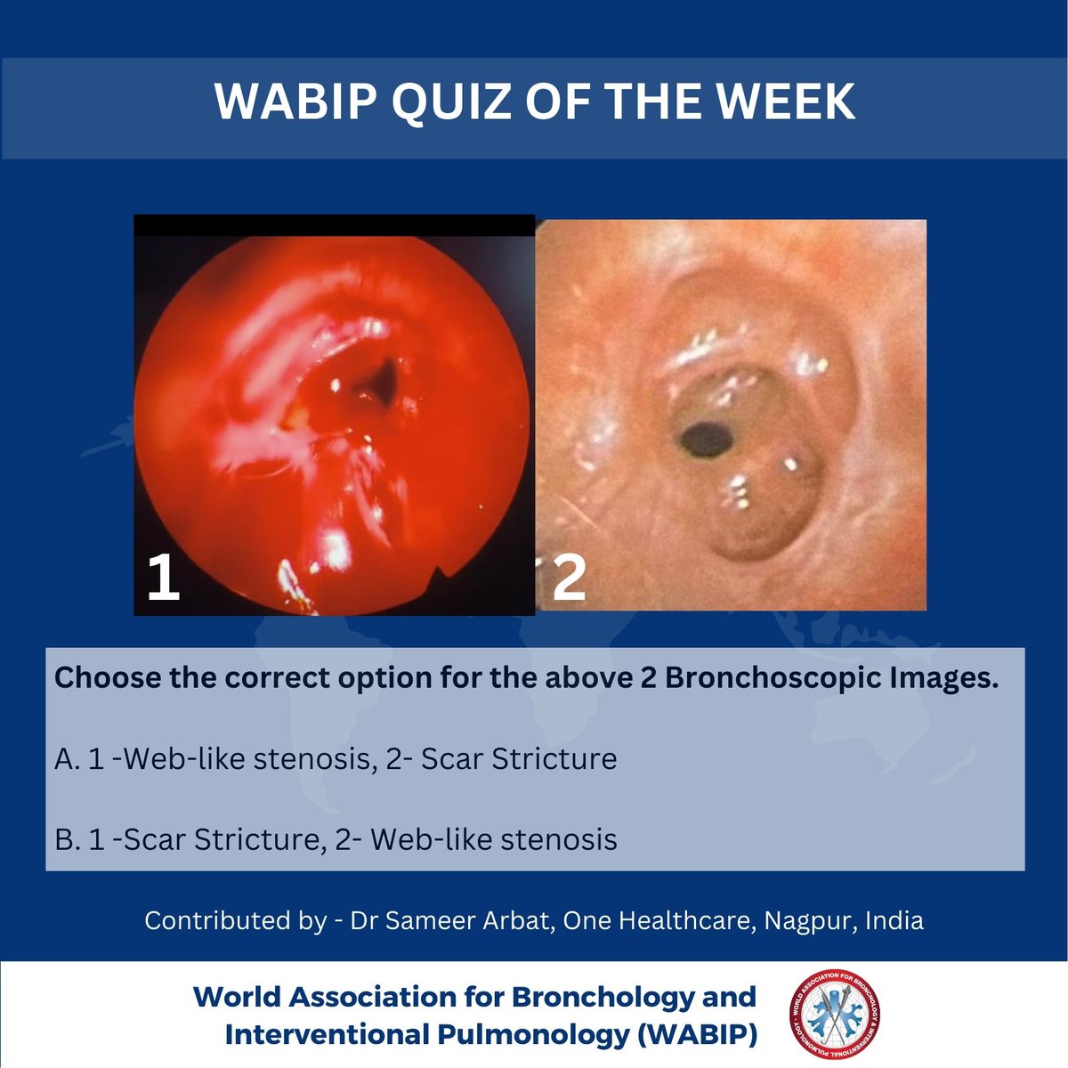Are you excited for the WABIP “Quiz of the Week”?
Share your answers in comments.
#wabip #interventionalpulmonology #wabipnewsletter
#bronchoscopy #roboticbronchoscopy #ebus #cryotherapy
#stenting #lungcancer #lungnodule