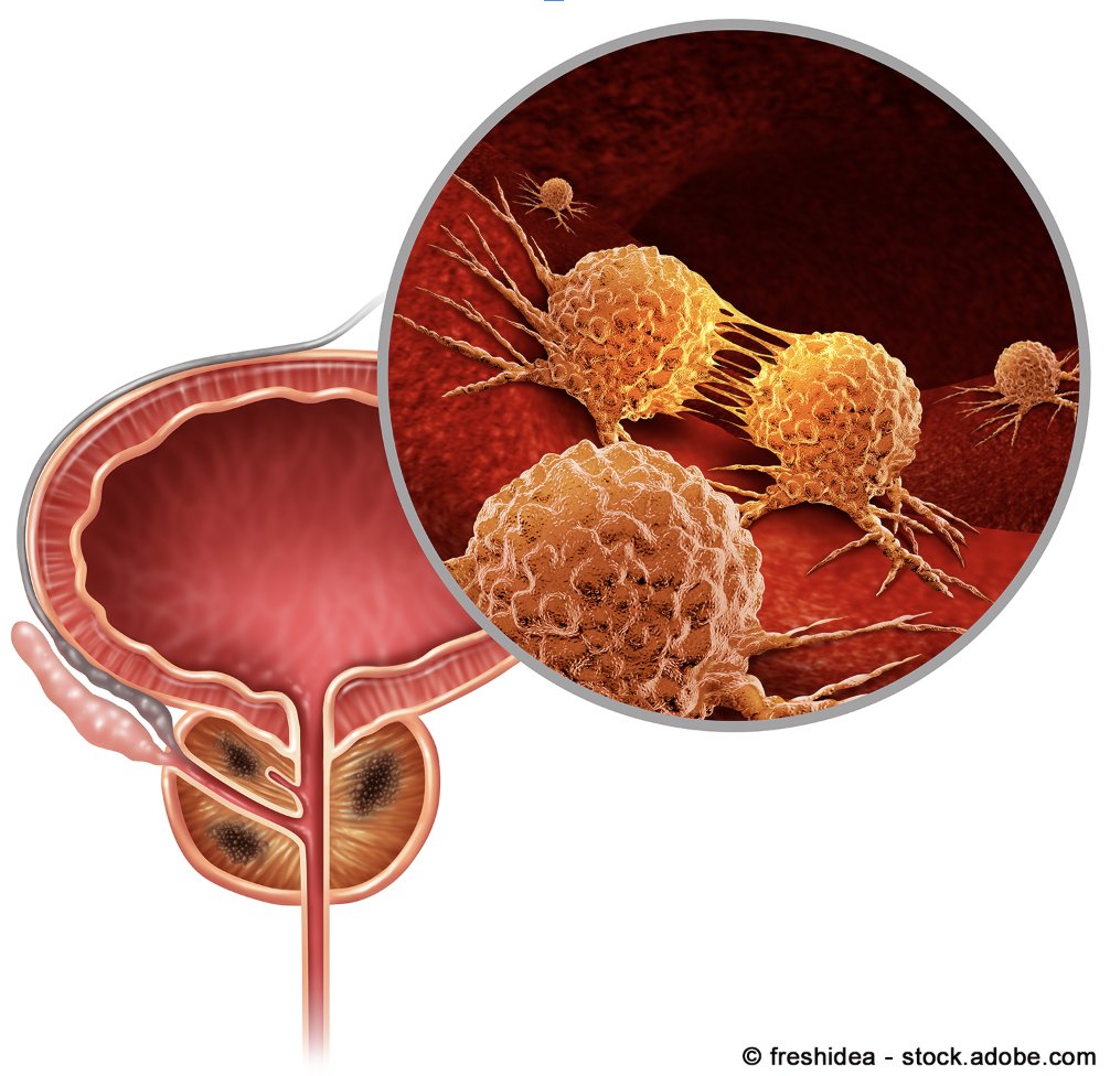 According to findings from the phase 2 TATCIST trial, FPI-2265 demonstrated activity in a heavily pretreated population of patients with metastatic castration-resistant prostate cancer. @AACR #AACR24 #pcsm onclive.com/view/psma-dire…