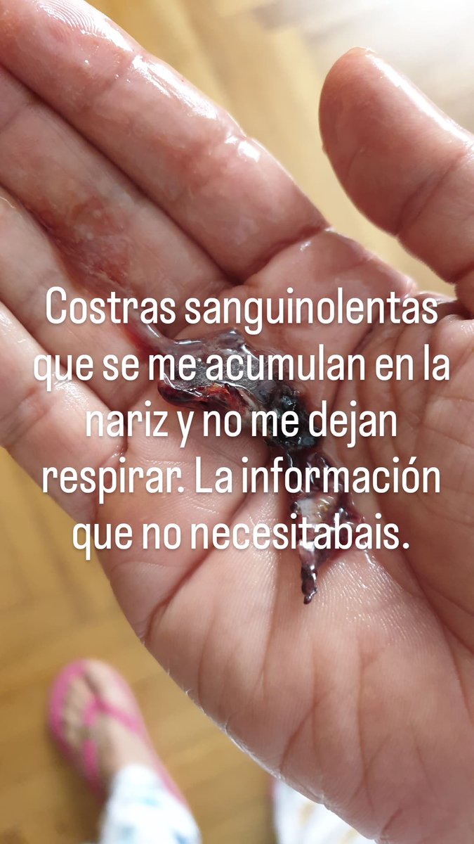 Costras sanguinolentas que se me acumulan en la nariz y no me dejan respirar. Cortesía de FOLFIRI+bevacizumab (Avastin). La información que no necesitabais.