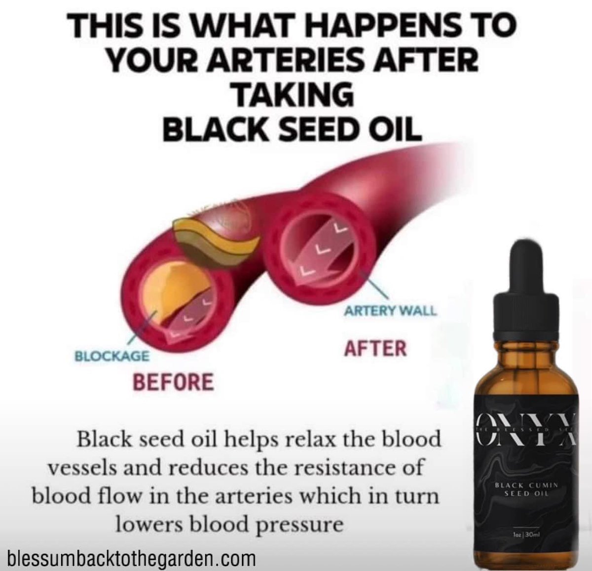 I think I’m going to buy some black seed oil today.  The Egyptians said it cured everything but death.  I believe them.